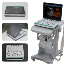 Laptop Ultrasound System With Trolley B